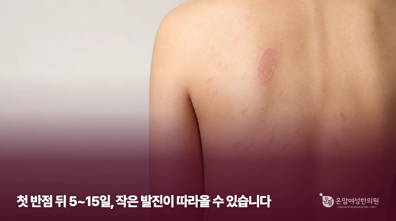 등에 큰 반점과 작은 반점이 함께 보이는 장미색비강진 설명 이미지