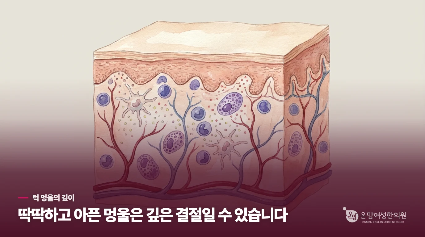 턱의 딱딱한 멍울은 왜 잘 나오지 않을까요?