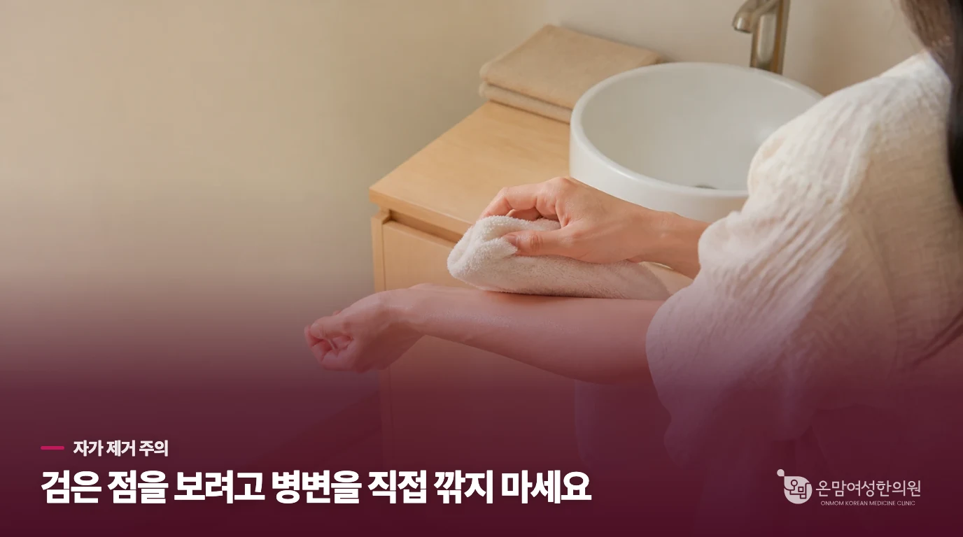검은 점이 보여도 집에서 깎아내지는 마세요