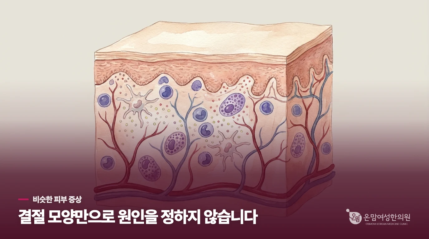 피부를 긁지 않아도 가려움이 계속되는 이유
