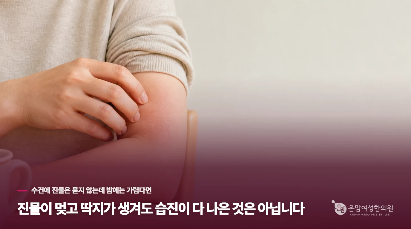 진물이 멎고 딱지가 생겨도 습진이 다 나은 것은 아닙니다