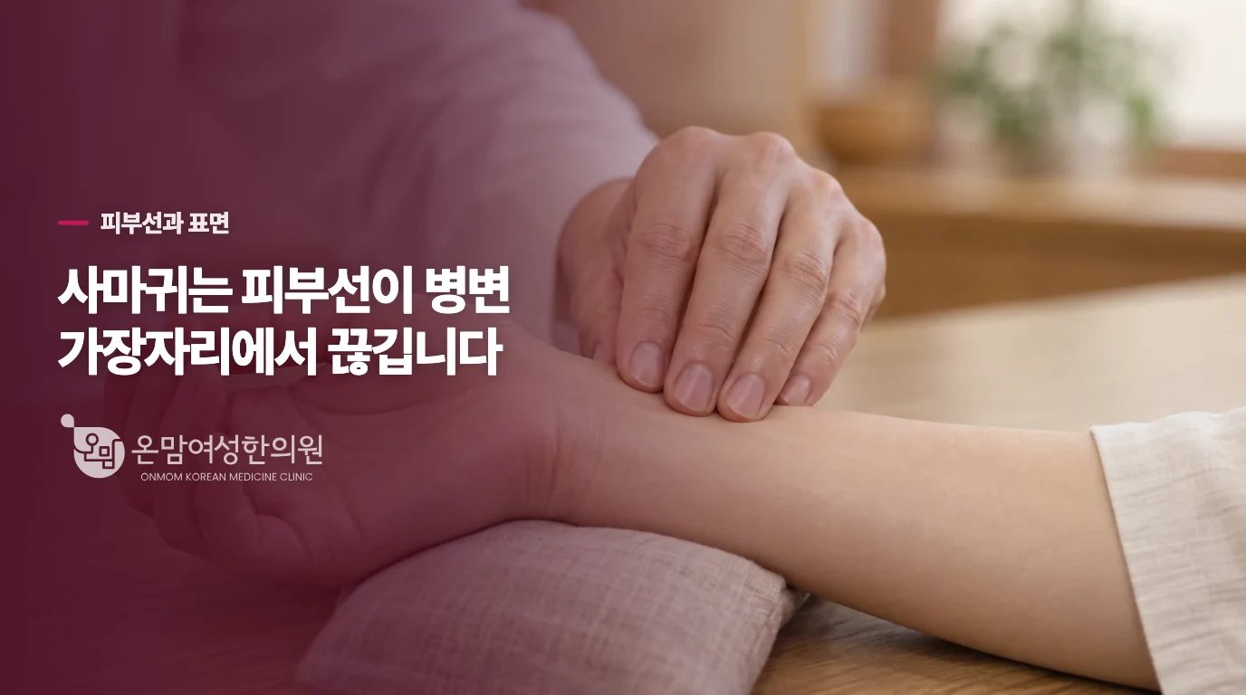 피부선이 병변을 가로지르는지 살펴보세요
