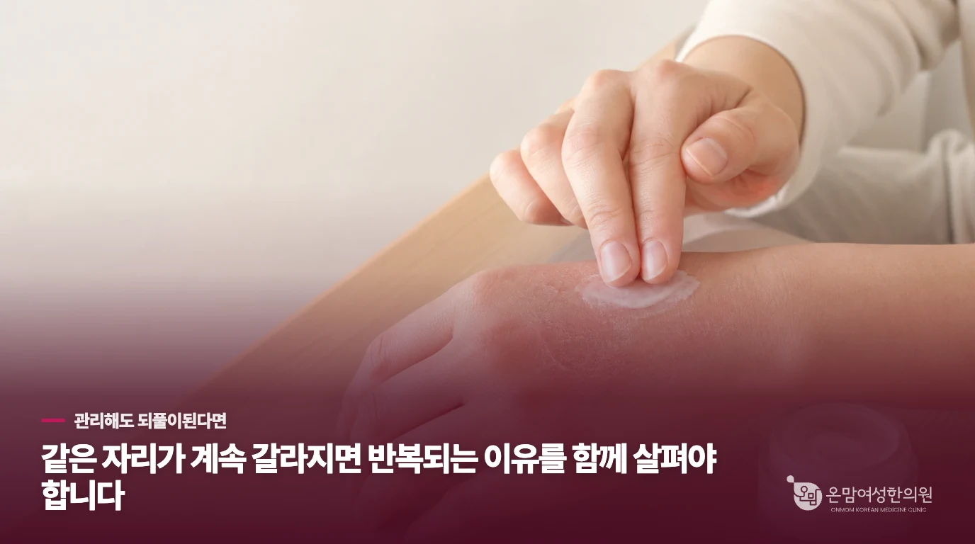 같은 자리가 계속 갈라지면 반복되는 이유를 함께 살펴야 합니다