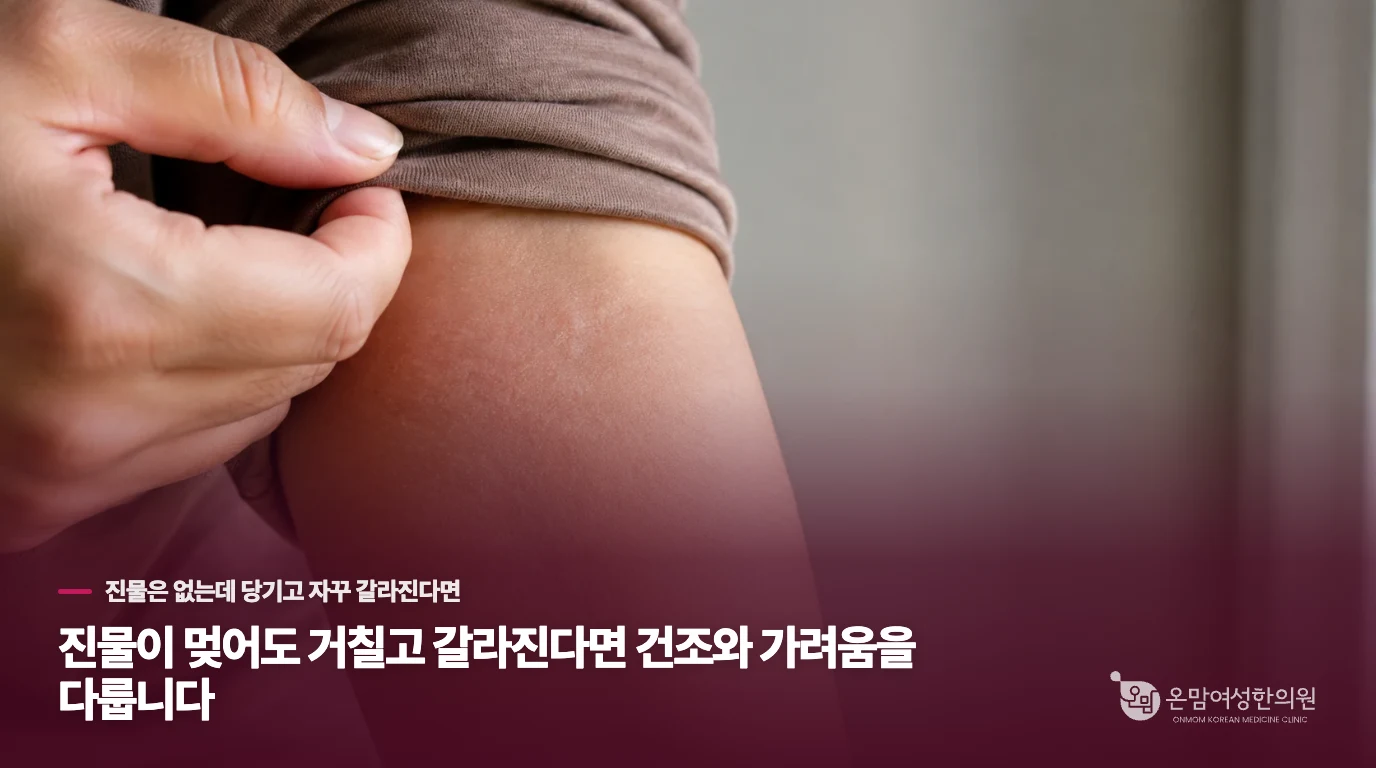 진물이 멎어도 거칠고 갈라진다면 건조와 가려움을 다룹니다