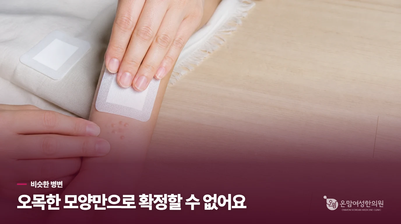 가운데가 오목해도 집에서 진단하지 마세요