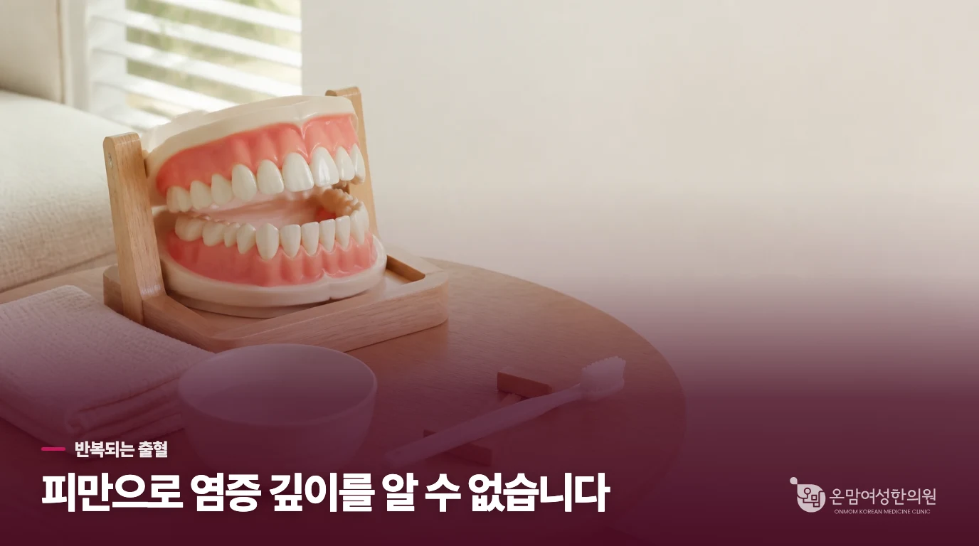 피의 양만으로 잇몸 상태를 판단할 수 없는 이유