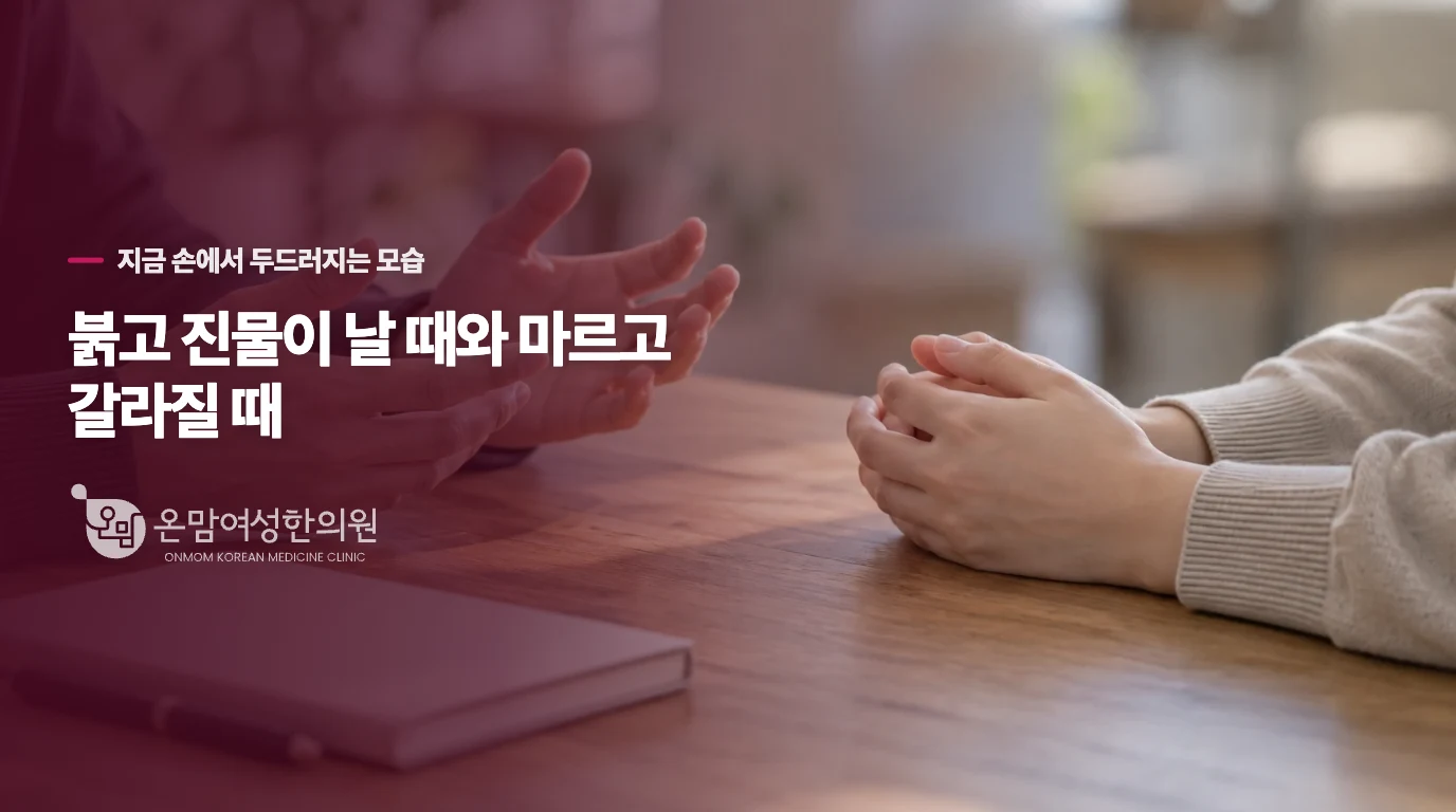 붉고 진물이 날 때와 마르고 갈라질 때
