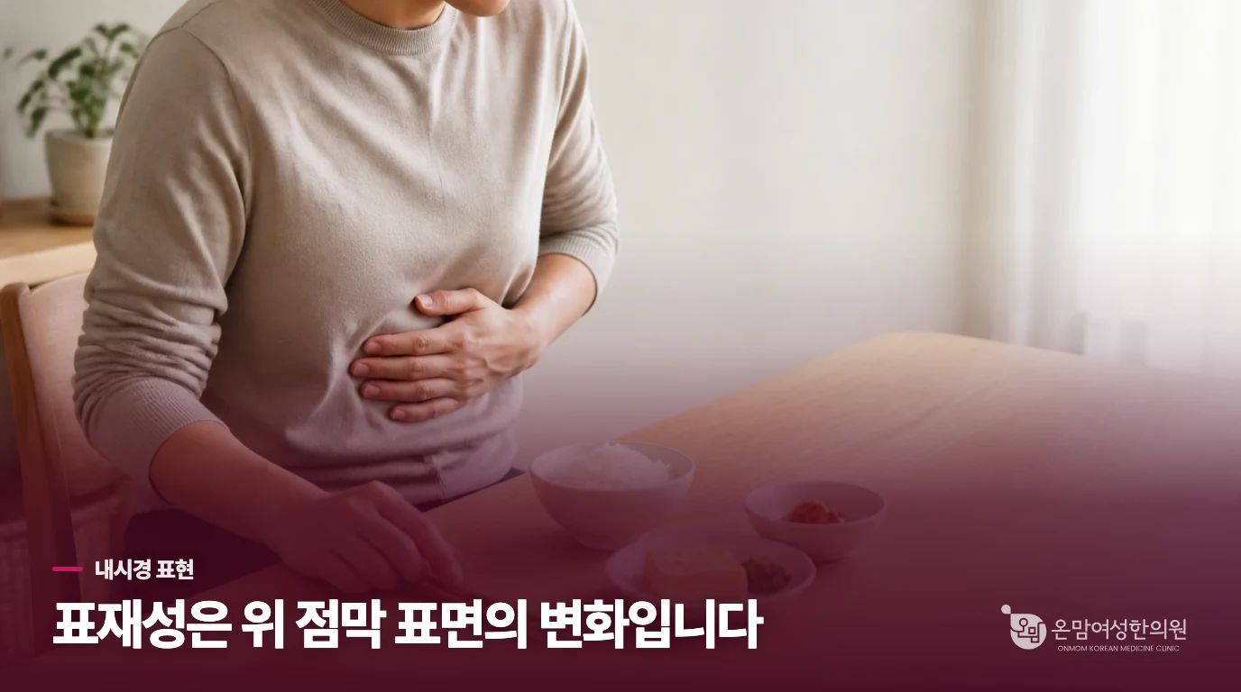 내시경의 ‘표재성’은 위 점막 표면의 변화를 가리킵니다